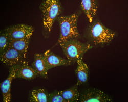Human lung epithelial cells treated with RCM-1.